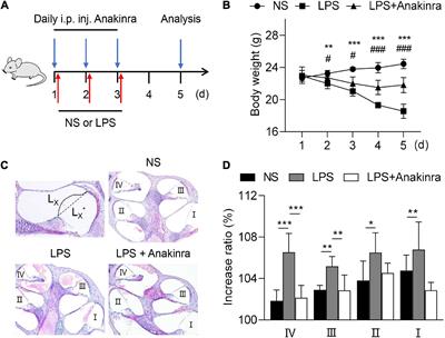 Protective effect of anakinra on audiovestibular function in a murine model of endolymphatic hydrops
